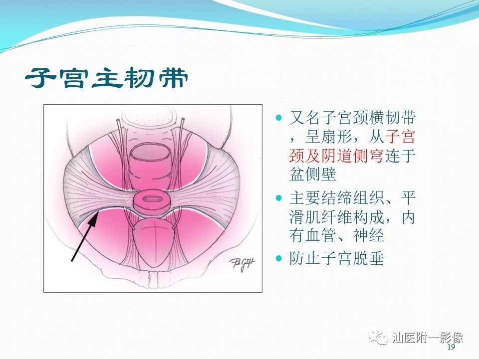 影像PPT - 【PPT】女性盆腔结构解剖复习-19