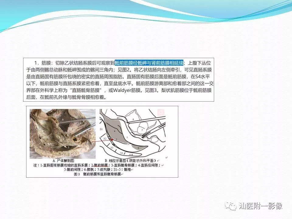 影像PPT - 【PPT】女性盆腔结构解剖复习-51