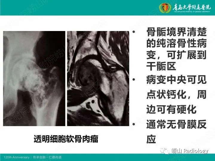 影像PPT - 【PPT】软骨肉瘤-27
