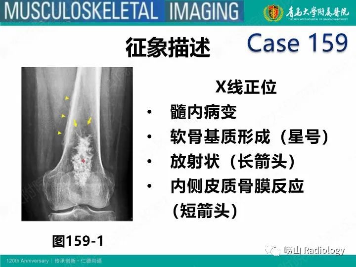 影像PPT - 【PPT】软骨肉瘤-33