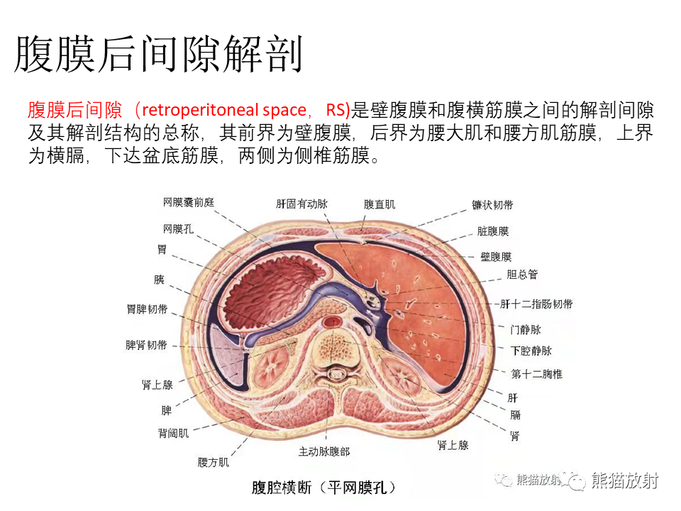 影像PPT - 【病例】腹膜后副神经节瘤 VS 平滑肌肉瘤-22