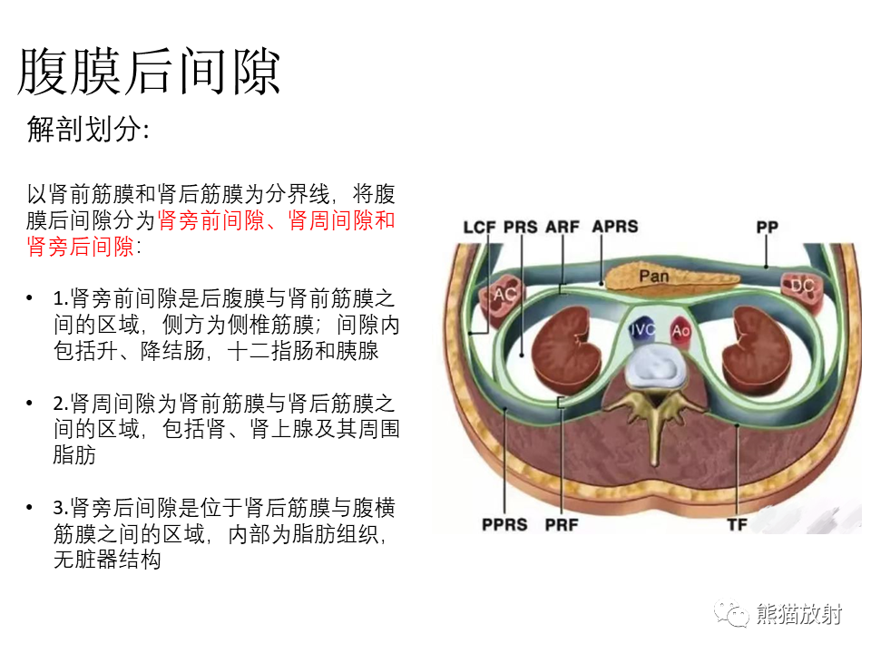 影像PPT - 【病例】腹膜后副神经节瘤 VS 平滑肌肉瘤-23