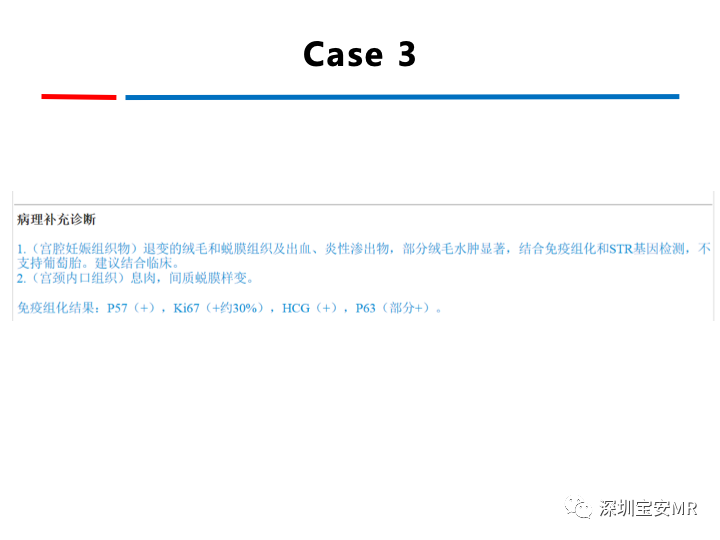 影像PPT - 【PPT】妊娠滋养细胞疾病-66