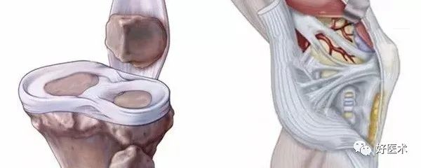 影像PPT - 56张高清图,牢记半月板的解剖-30 影像PPT - 56张高清图,牢记半月板的解剖-30