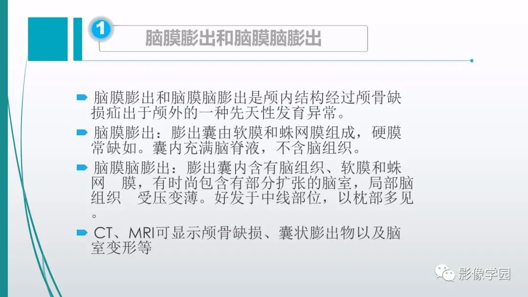 影像PPT - 【PPT】颅脑先天性畸形及发育异常的影像诊断-5
