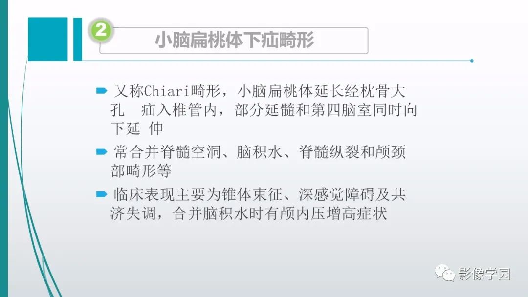影像PPT - 【PPT】颅脑先天性畸形及发育异常的影像诊断-8