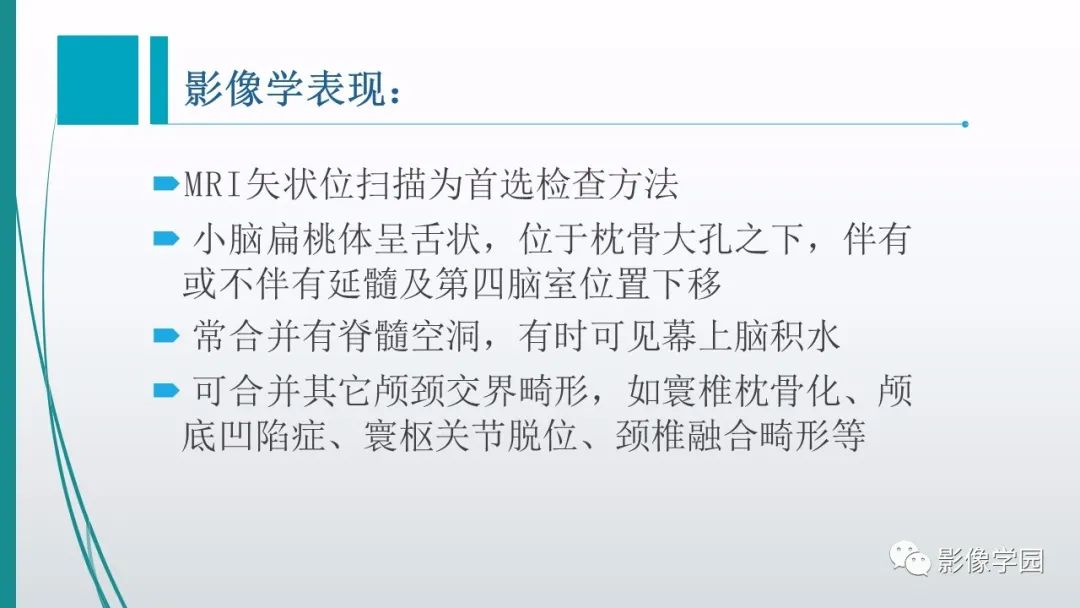 影像PPT - 【PPT】颅脑先天性畸形及发育异常的影像诊断-11