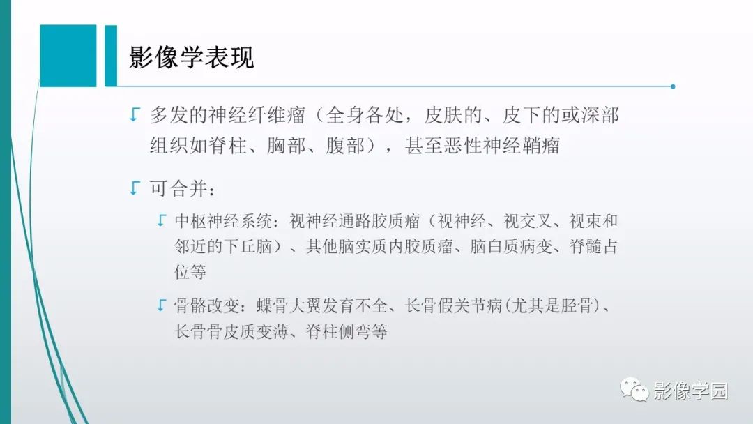 影像PPT - 【PPT】颅脑先天性畸形及发育异常的影像诊断-33