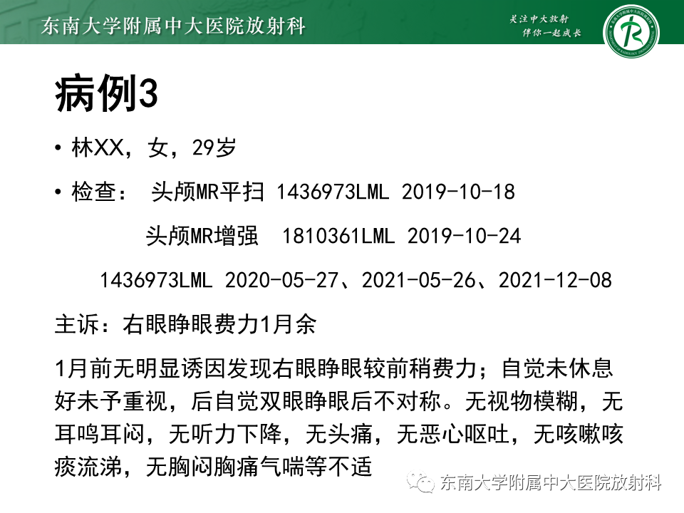 影像PPT - 【PPT】多发性硬化-22 影像PPT - 【PPT】多发性硬化-22