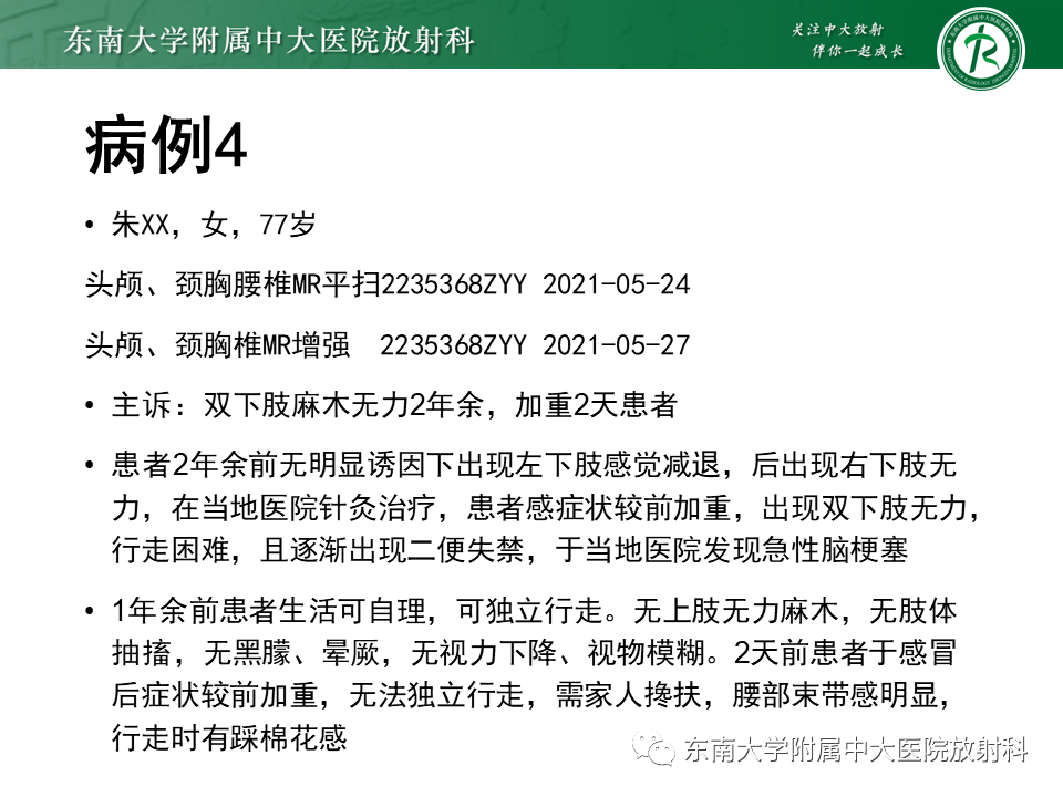 影像PPT - 【PPT】多发性硬化-37 影像PPT - 【PPT】多发性硬化-37
