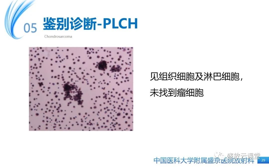 影像PPT - 【PPT】肺淋巴管肌瘤病-28