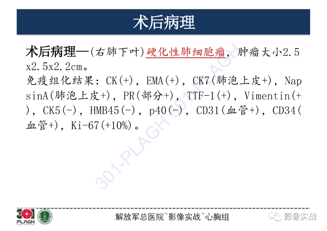 影像PPT - 【病例】硬化性肺细胞瘤1例CT影像-17