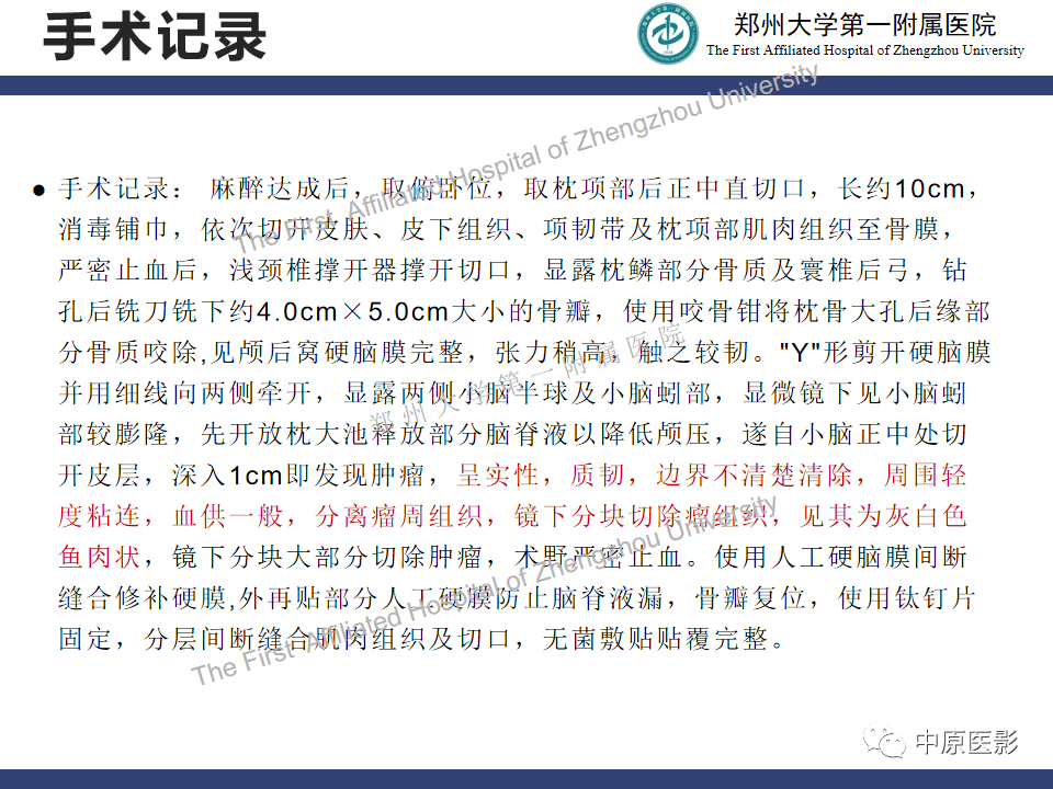 影像PPT - 【病例】小脑节细胞胶质瘤1例MR影像-11