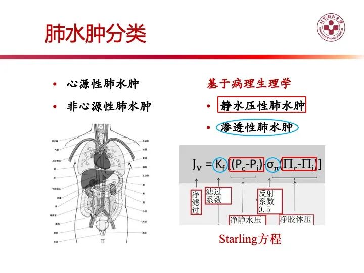 影像PPT - 【PPT】肺水肿的临床与影像-4