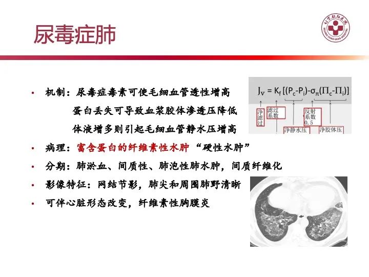 影像PPT - 【PPT】肺水肿的临床与影像-17