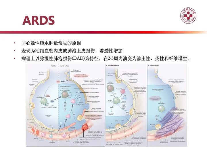 影像PPT - 【PPT】肺水肿的临床与影像-22