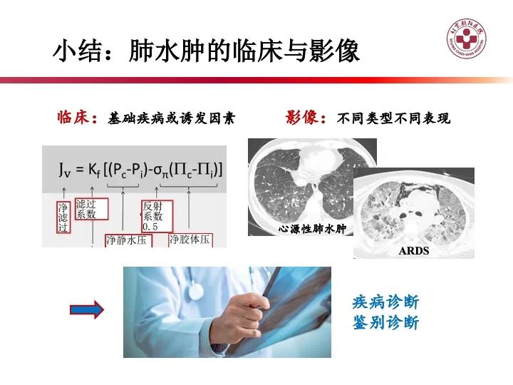 影像PPT - 【PPT】肺水肿的临床与影像-32