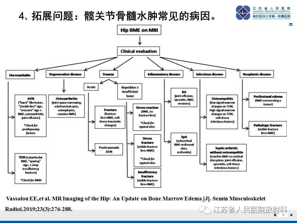 影像PPT - 【PPT】髋关节一过性骨质疏松-22