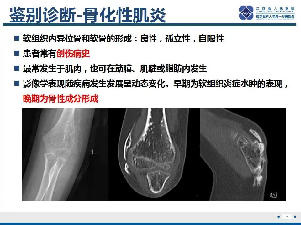 影像PPT - 【PPT】肿瘤样钙质沉着症-30
