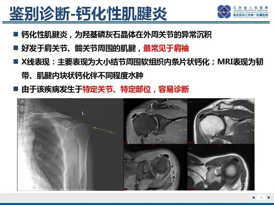 影像PPT - 【PPT】肿瘤样钙质沉着症-31
