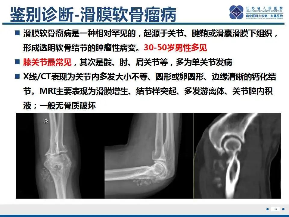 影像PPT - 【PPT】肿瘤样钙质沉着症-33