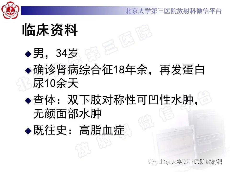 影像PPT - 【PPT】颅内静脉窦血栓-2