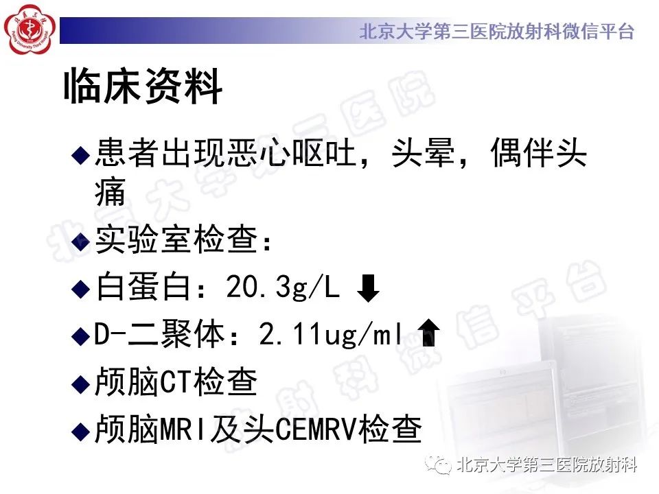 影像PPT - 【PPT】颅内静脉窦血栓-4