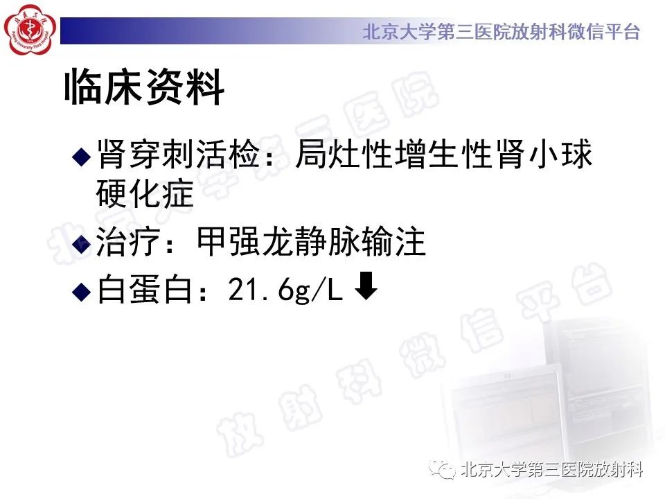 影像PPT - 【PPT】颅内静脉窦血栓-3