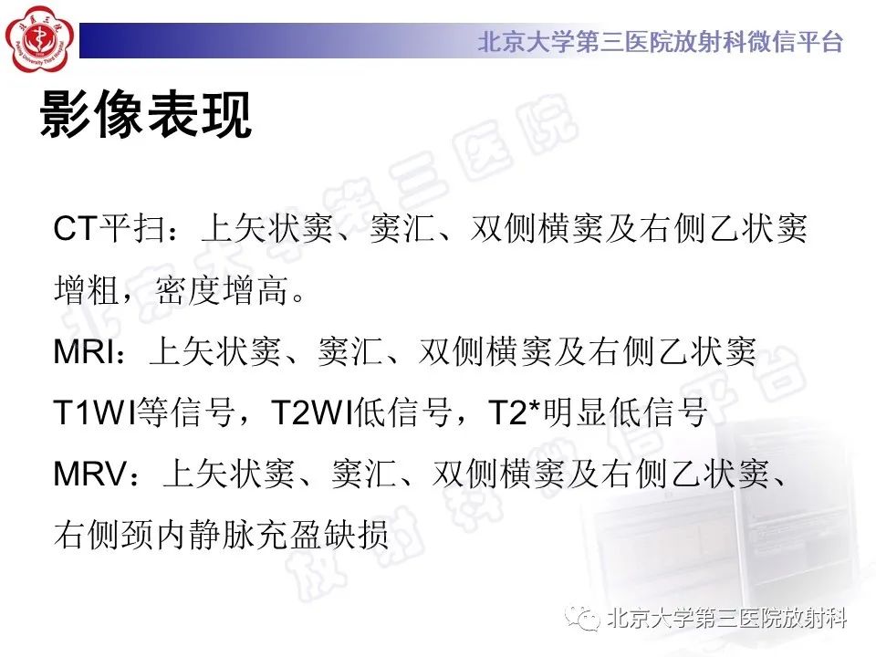 影像PPT - 【PPT】颅内静脉窦血栓-10
