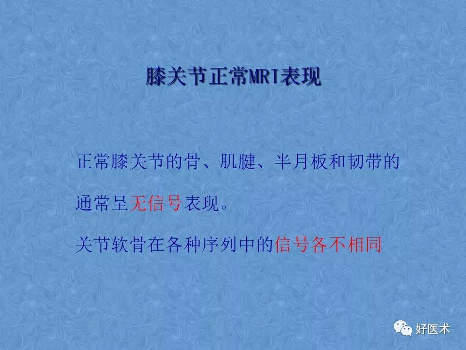 影像PPT - 【PPT】膝关节MRI正常解剖-2