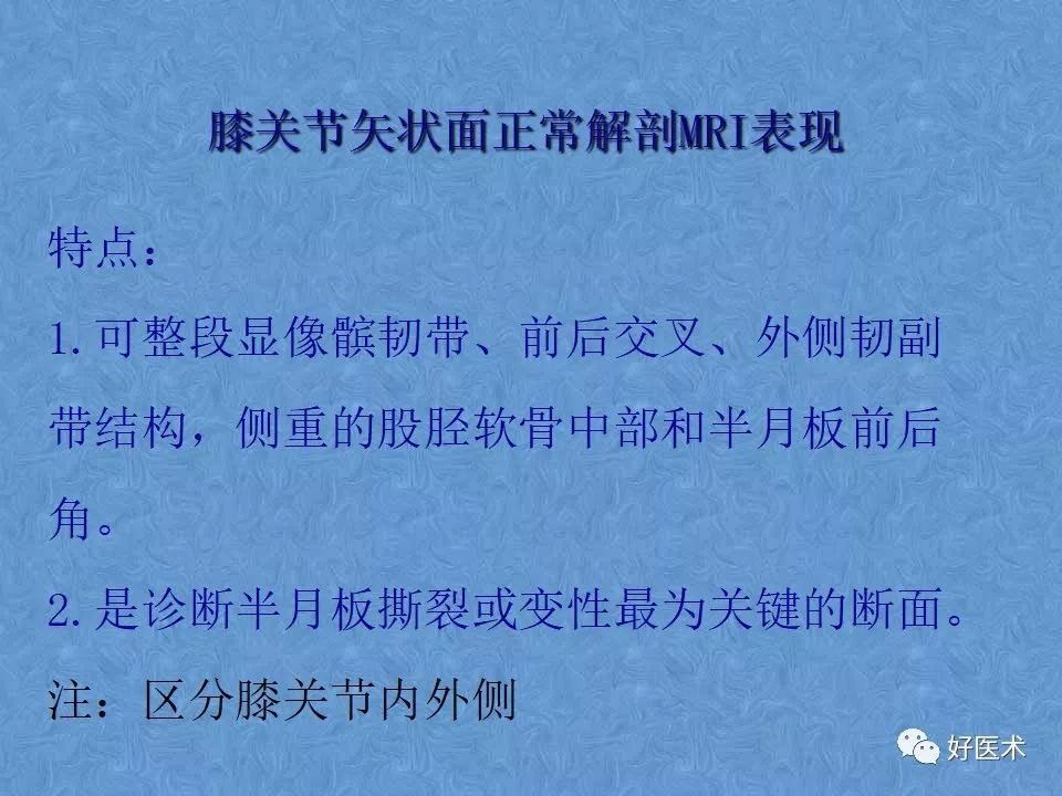 影像PPT - 【PPT】膝关节MRI正常解剖-4