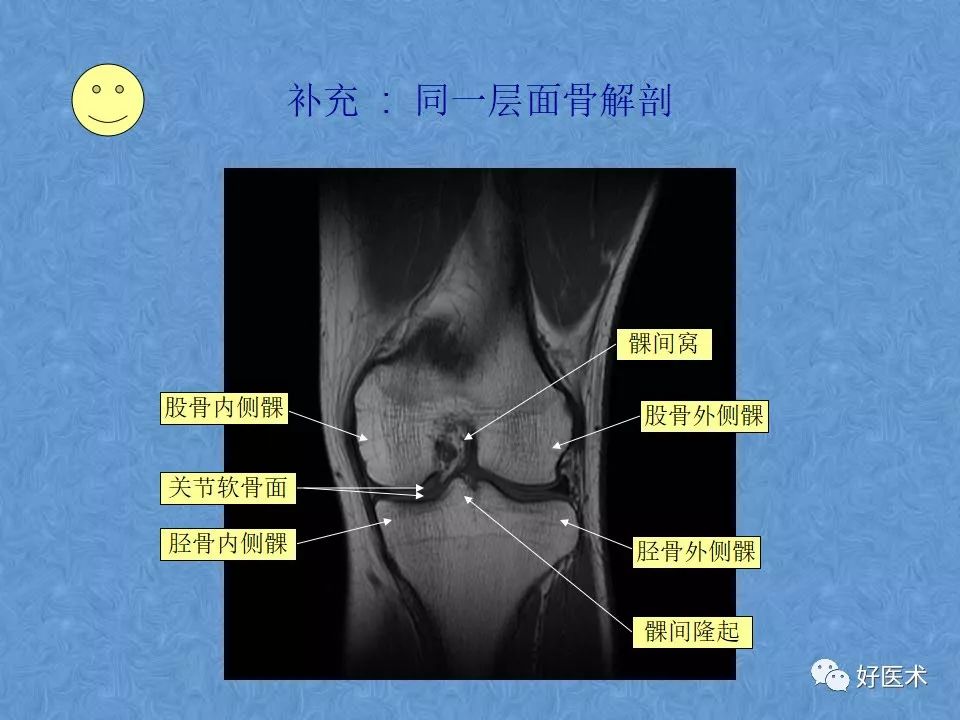 影像PPT - 【PPT】膝关节MRI正常解剖-37