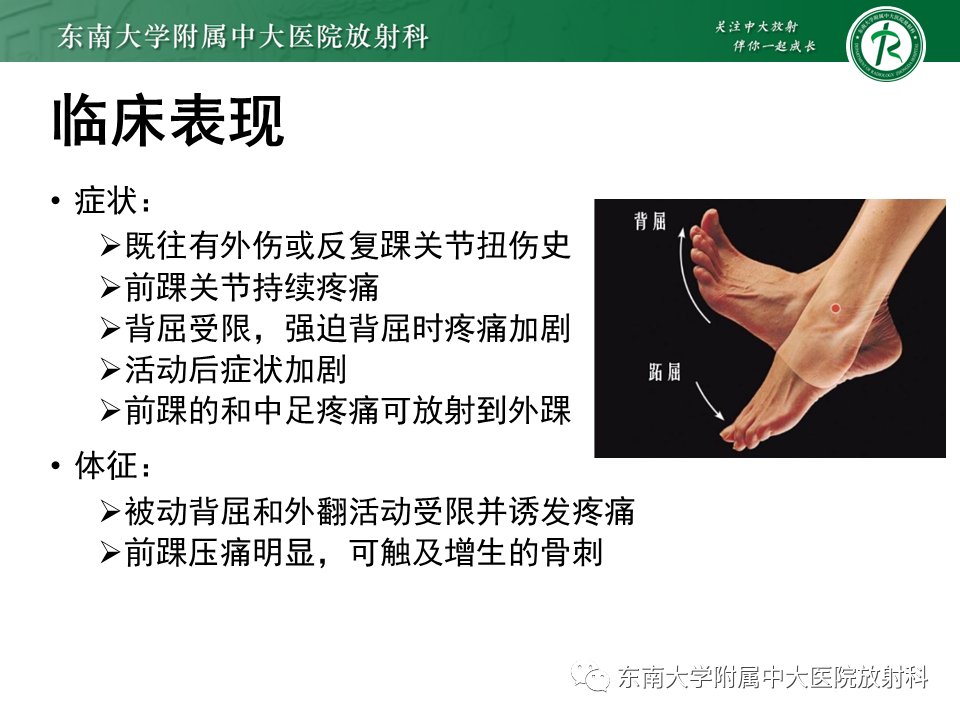 影像PPT - 【PPT】踝关节撞击综合征-12
