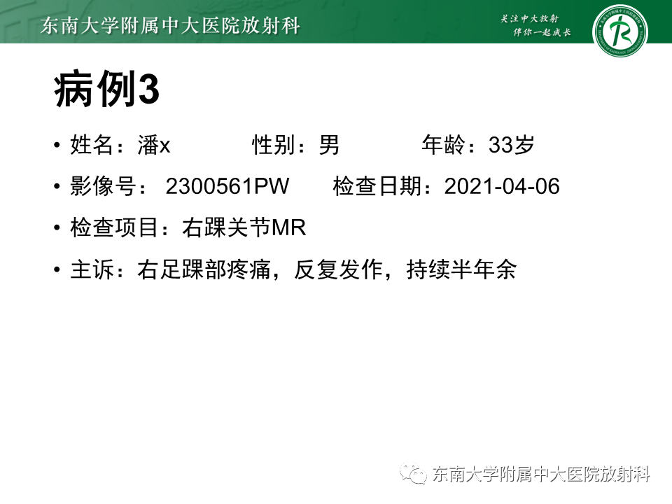 影像PPT - 【PPT】踝关节撞击综合征-14