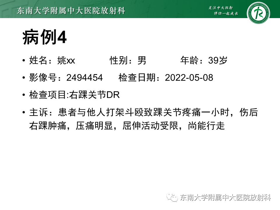 影像PPT - 【PPT】踝关节撞击综合征-31