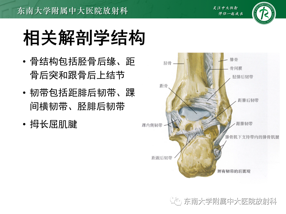 影像PPT - 【PPT】踝关节撞击综合征-34
