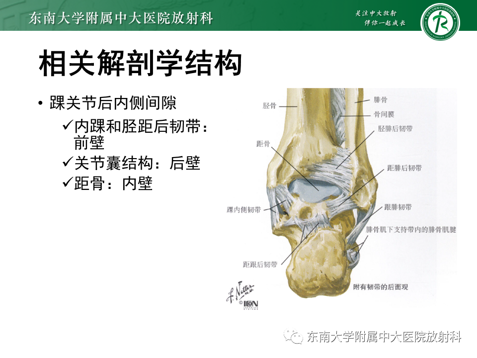 影像PPT - 【PPT】踝关节撞击综合征-42