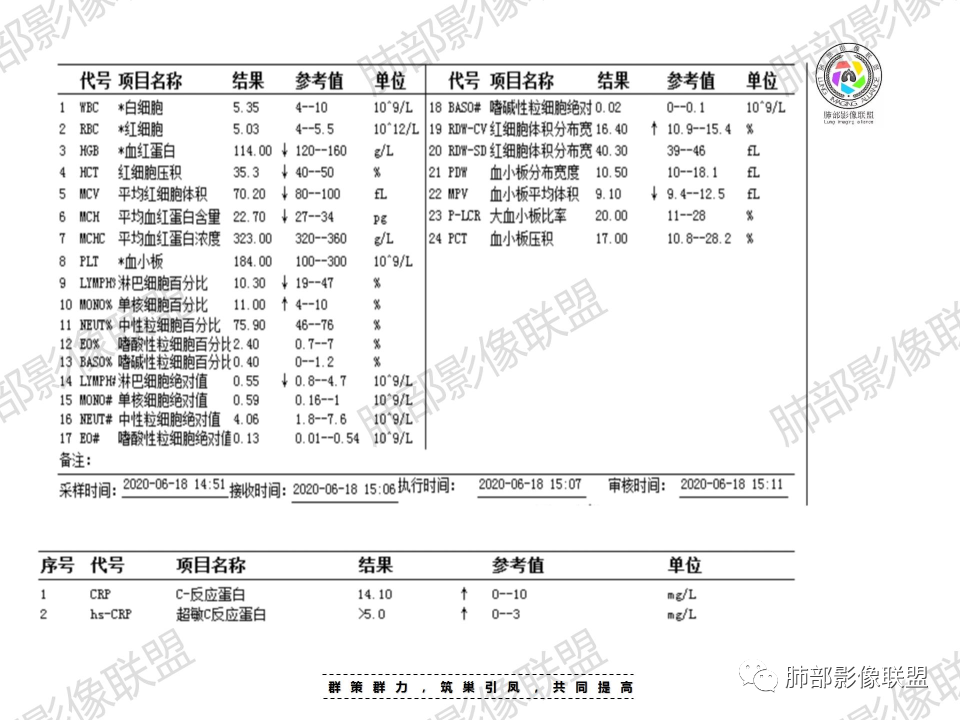 影像PPT - 【病例】鼻咽癌患者肺内出现多发肿块、结节就一定是转移瘤吗？-5