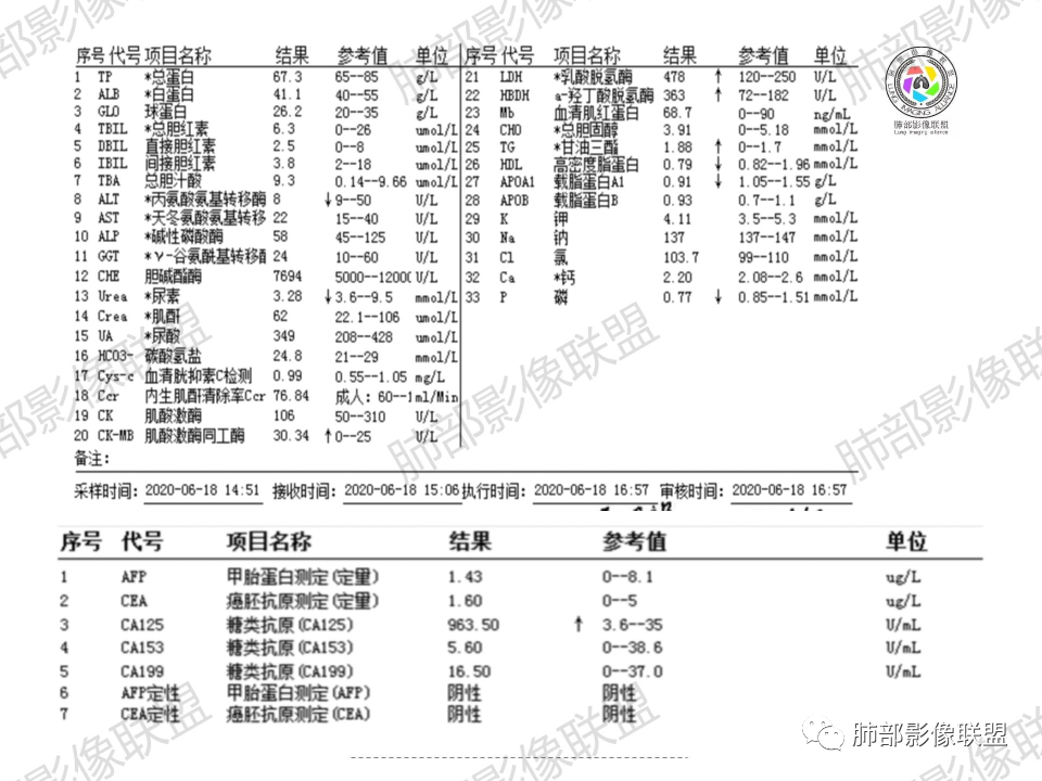影像PPT - 【病例】鼻咽癌患者肺内出现多发肿块、结节就一定是转移瘤吗？-6