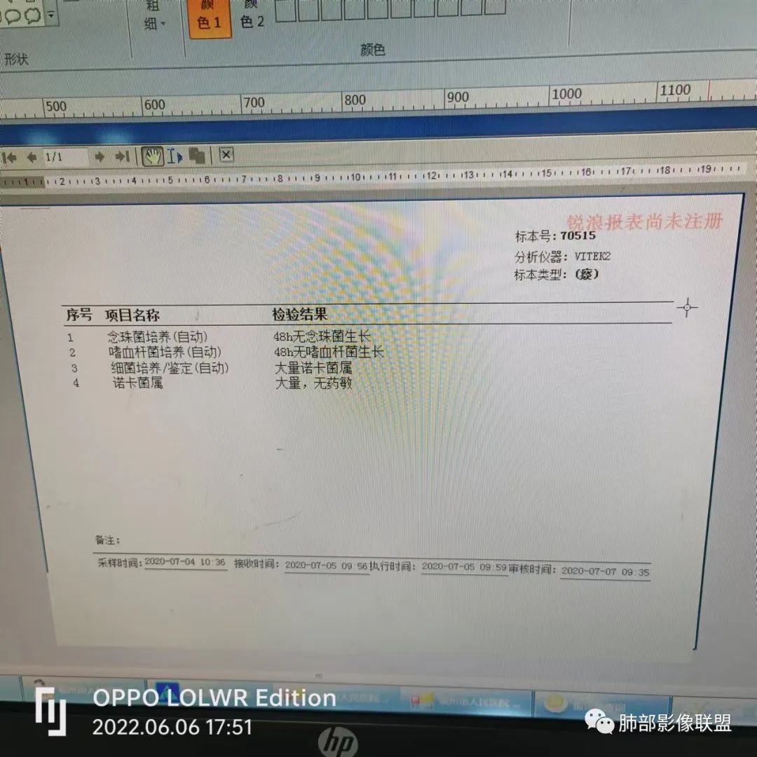 影像PPT - 【病例】鼻咽癌患者肺内出现多发肿块、结节就一定是转移瘤吗？-33