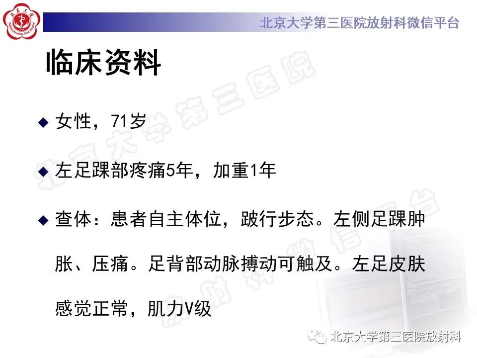 影像PPT - 【PPT】足舟骨缺血坏死-2
