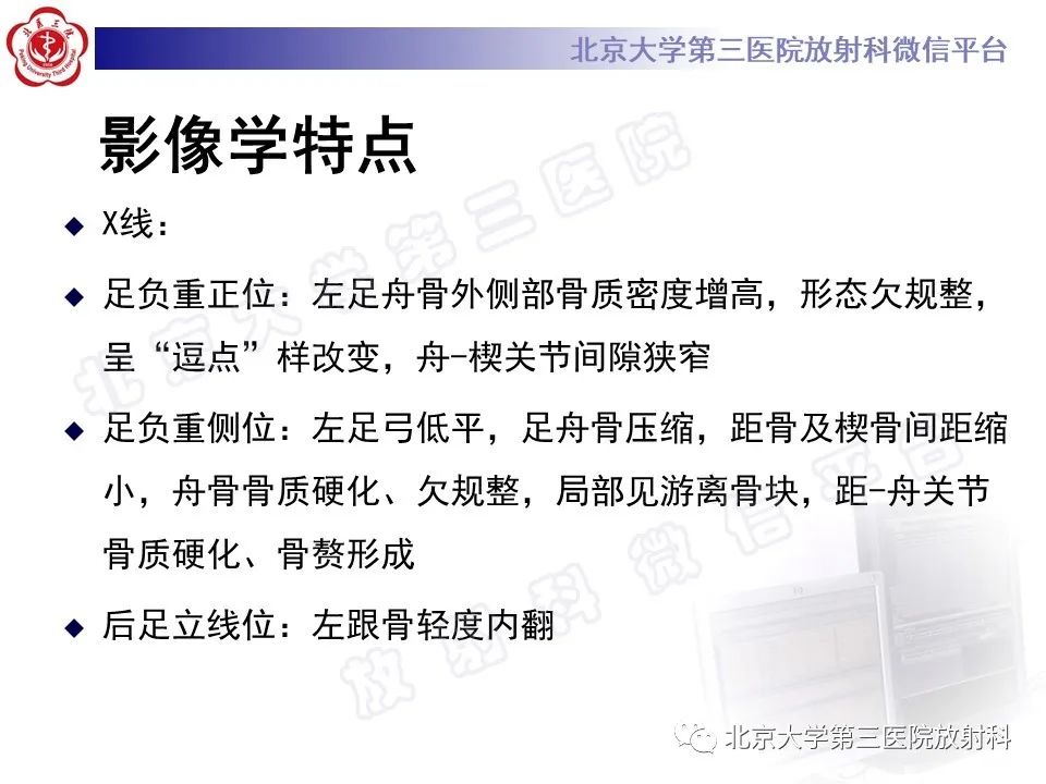 影像PPT - 【PPT】足舟骨缺血坏死-14