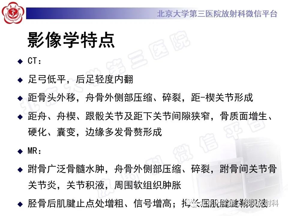 影像PPT - 【PPT】足舟骨缺血坏死-15