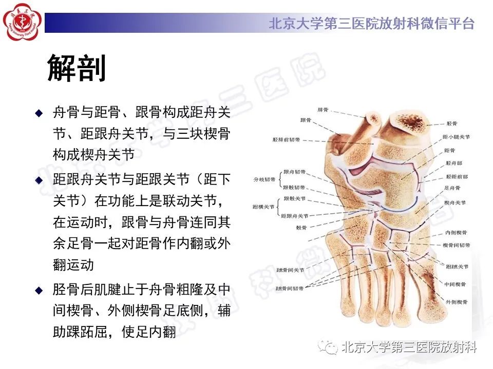 影像PPT - 【PPT】足舟骨缺血坏死-18
