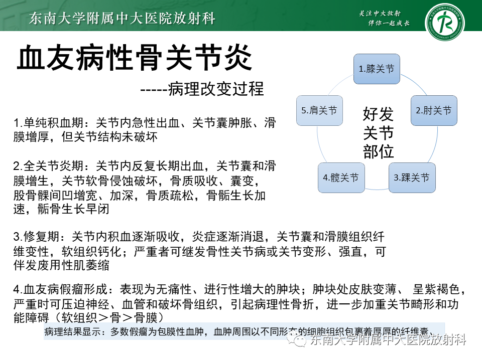 影像PPT - 【PPT】血友病性骨关节炎-16 影像PPT - 【PPT】血友病性骨关节炎-16