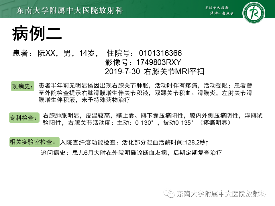 影像PPT - 【PPT】血友病性骨关节炎-24 影像PPT - 【PPT】血友病性骨关节炎-24