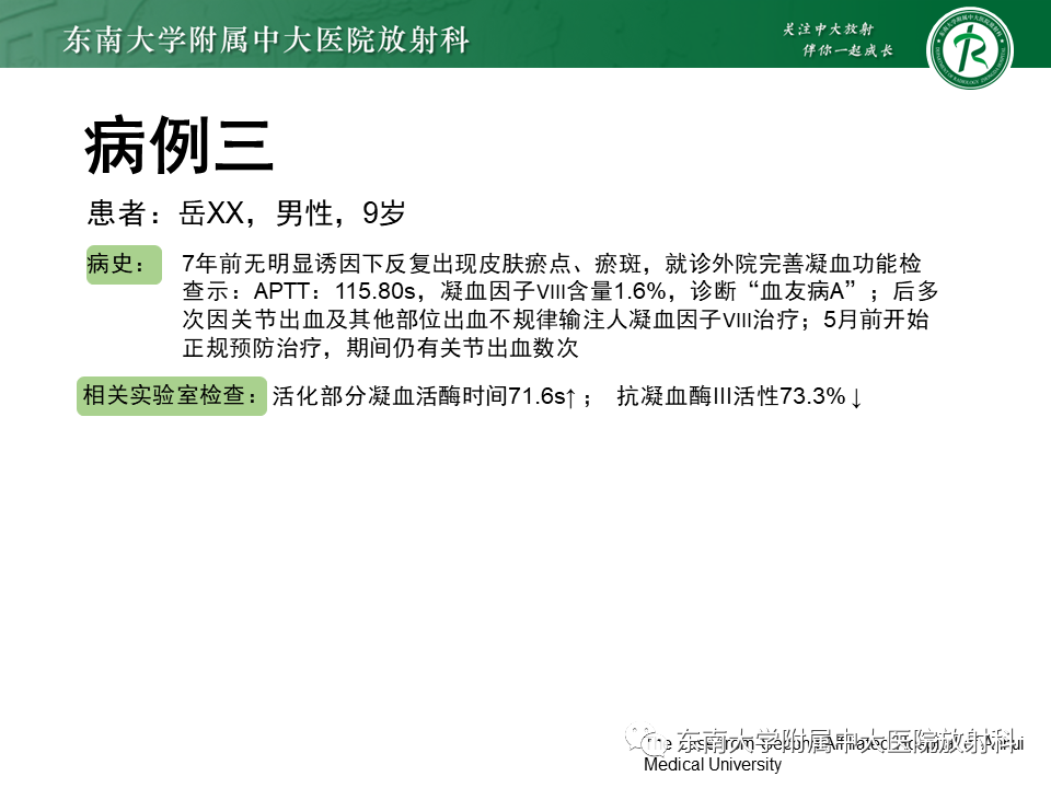 影像PPT - 【PPT】血友病性骨关节炎-27 影像PPT - 【PPT】血友病性骨关节炎-27