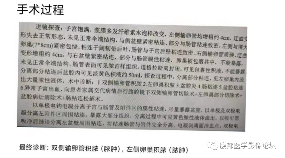 影像PPT - 【病例】双侧输卵管脓肿1例MR影像-9