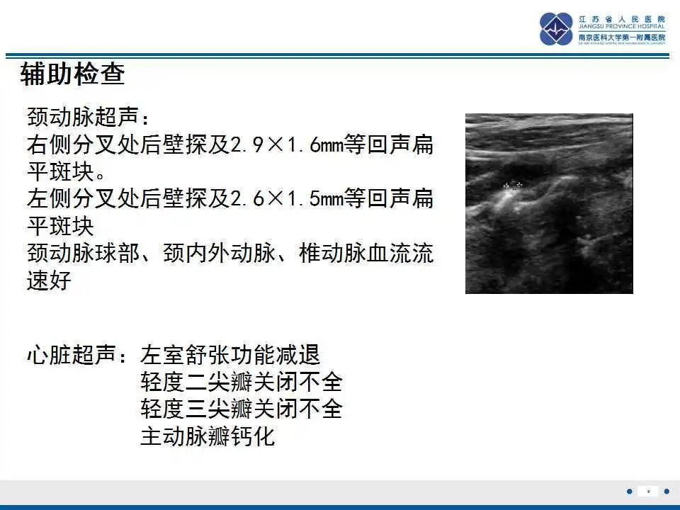 影像PPT - 【PPT】特鲁索综合征 Trousseau snydrome-7