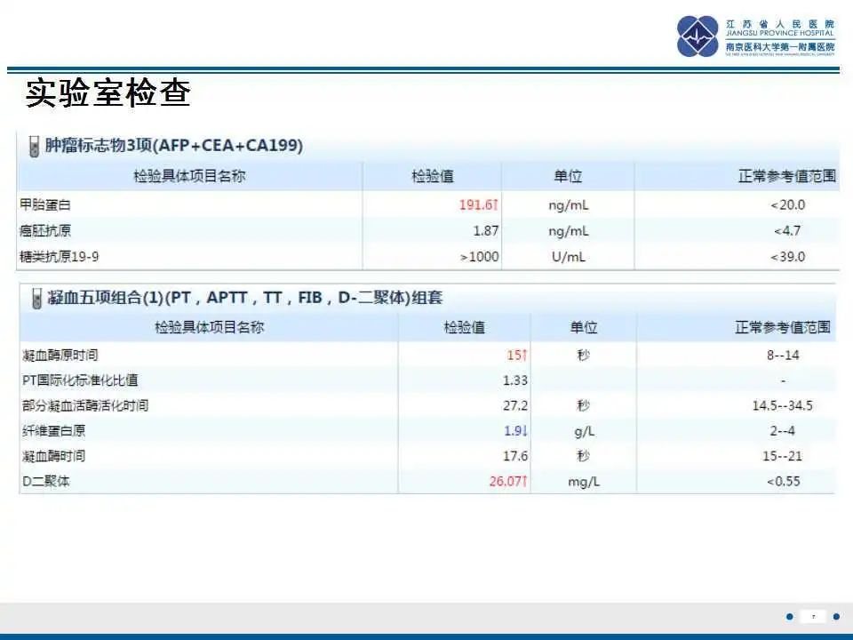 影像PPT - 【PPT】特鲁索综合征 Trousseau snydrome-8
